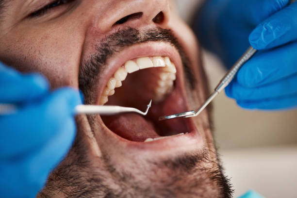 Best Cracked Tooth Emergency Dentist  in Vardaman, MS