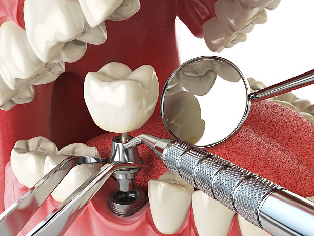 Best Broken Tooth Emergency  in Vardaman, MS